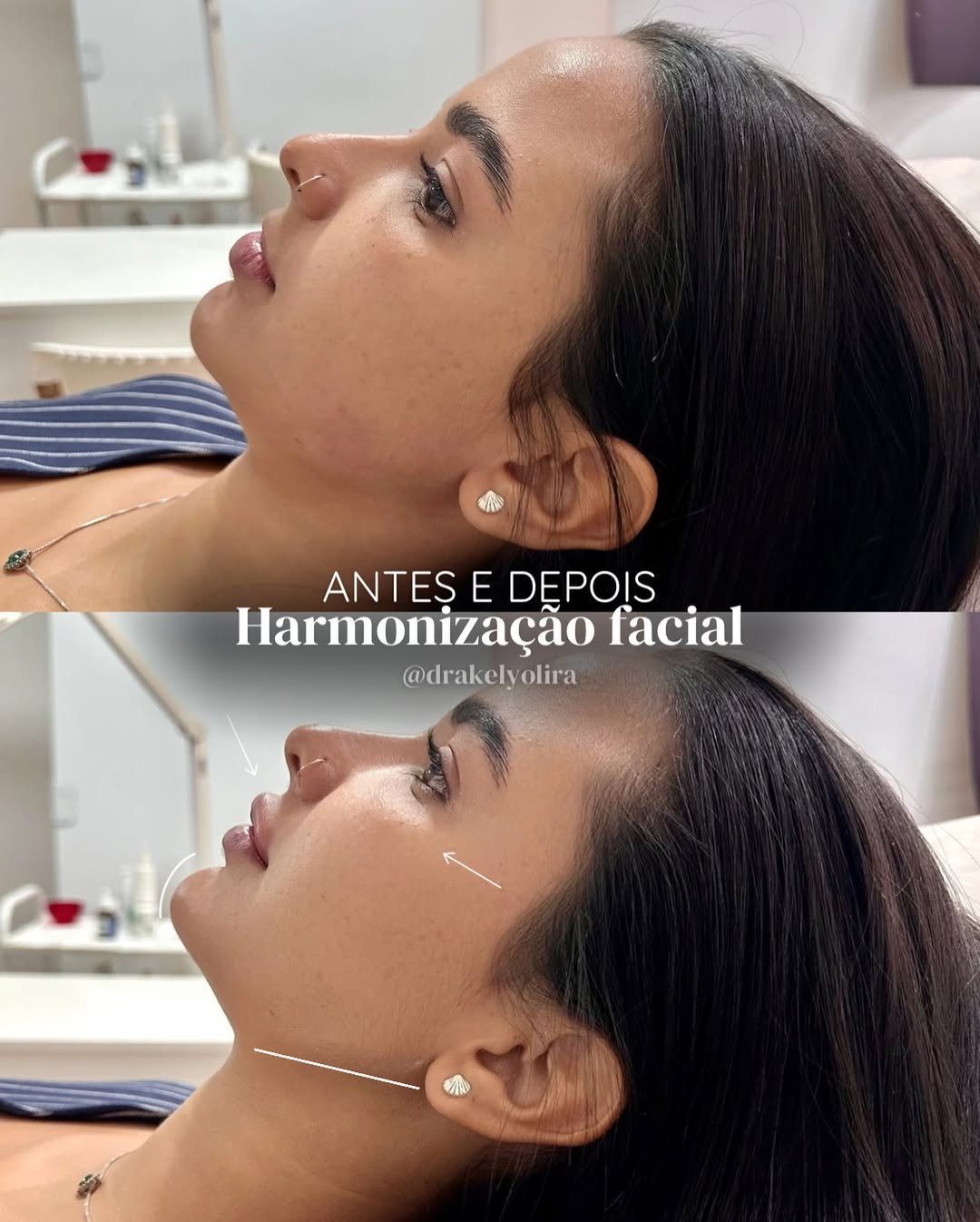 kelyolira-antesdepois-1