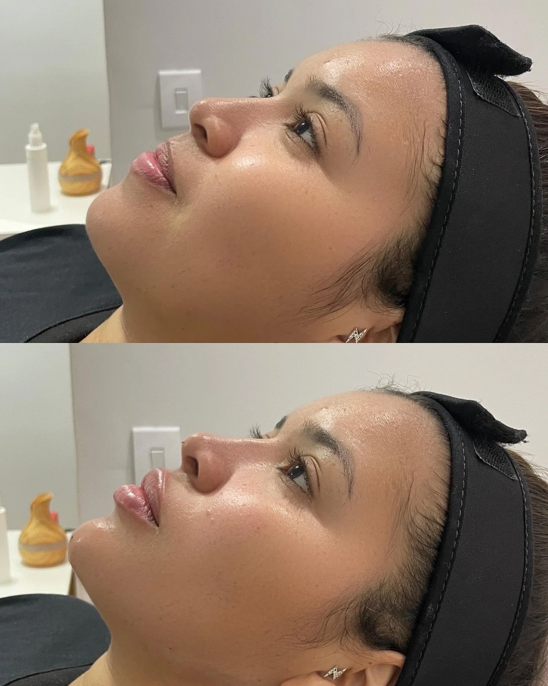 kelyolira-antesdepois-2