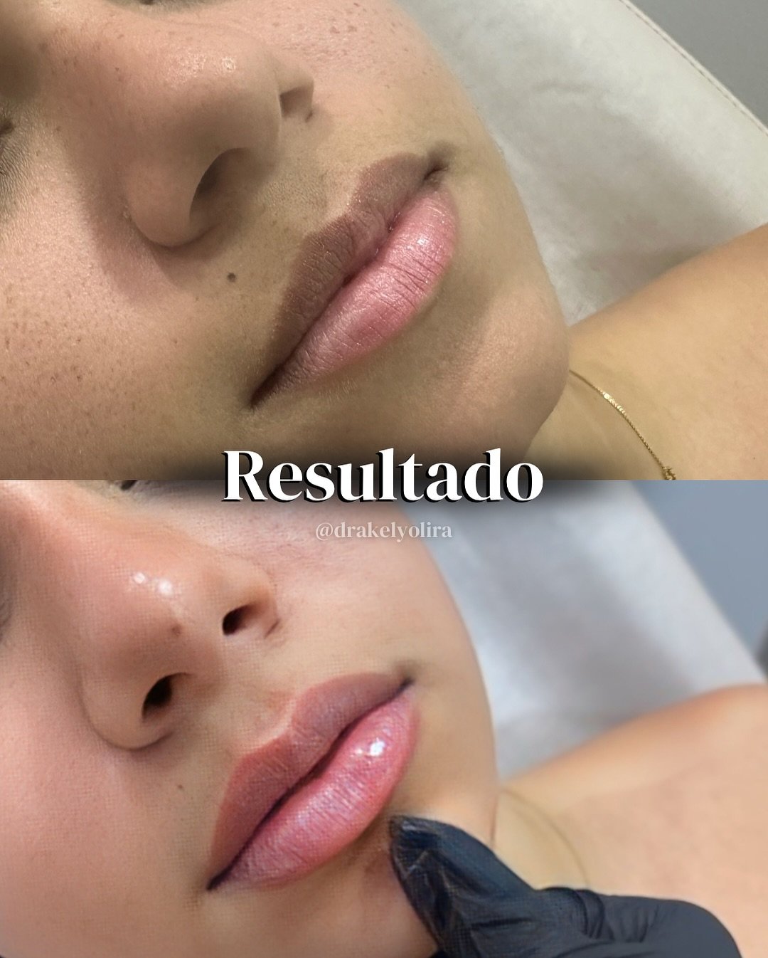 kelyolira-antesdepois-4